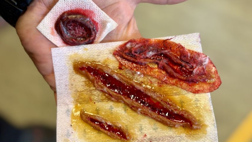 Die Wunden zum Aufkleben. Foto: Fadrina Hofmann